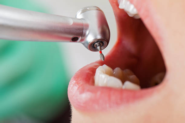 Best Urgent Tooth Repair  in Fergus Falls, MN